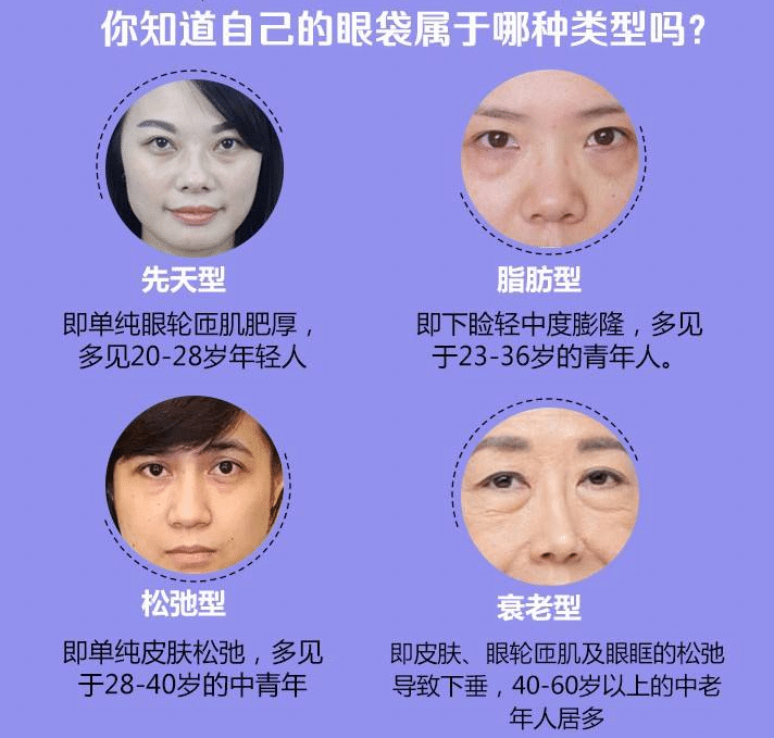 導(dǎo)致眼袋手術(shù)反彈的原因是什么?