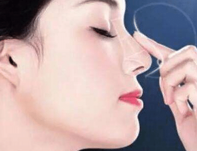 耳軟骨隆鼻 耳軟骨隆鼻