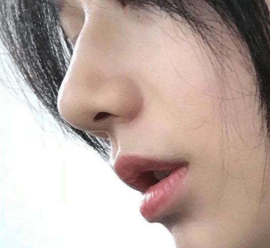 膠原蛋白隆鼻