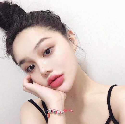 玻尿酸豐唇有什么優(yōu)點(diǎn)？豐唇后嘴巴很硬怎么辦？