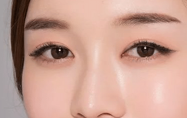 開眼角 開眼角