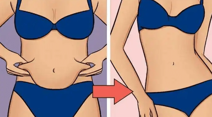 腹部吸脂 腹部吸脂