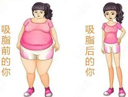 吸脂前后對(duì)比