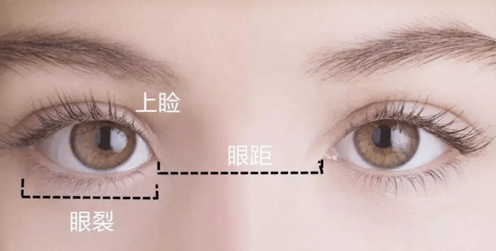 眼裂 眼裂