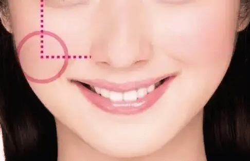 蘋果肌