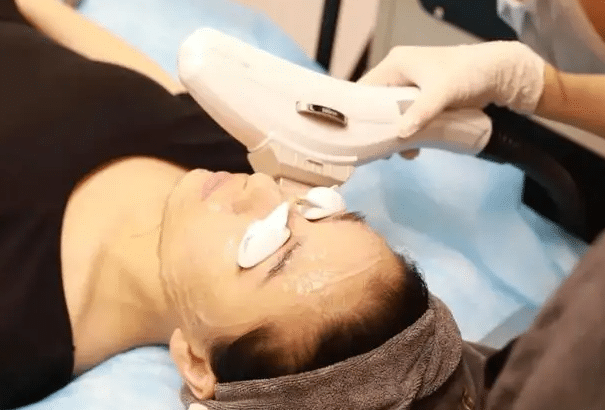 光子嫩膚 光子嫩膚