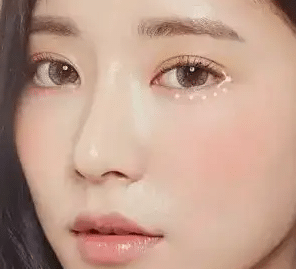 韓式三點(diǎn)雙眼皮