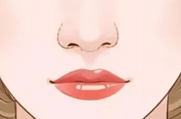 鼻翼縮小手術 鼻翼縮小手術