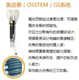 韓國奧齒泰 韓國奧齒泰