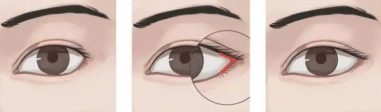 開(kāi)眼尾 開(kāi)眼尾