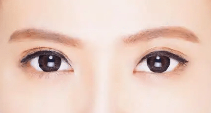 雙眼皮 雙眼皮