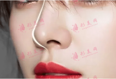隆鼻排斥會(huì)出現(xiàn)哪些癥狀，隆鼻適合哪些人群?
