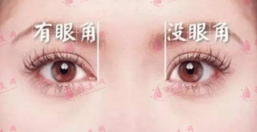 開眼角 開眼角