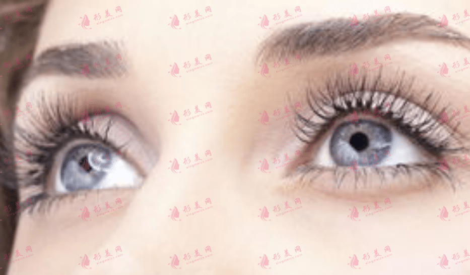 雙眼皮