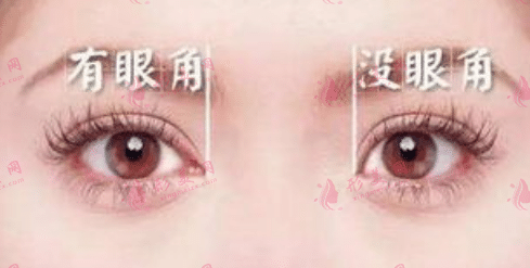 開眼角
