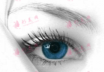 內(nèi)眥贅皮 內(nèi)眥贅皮