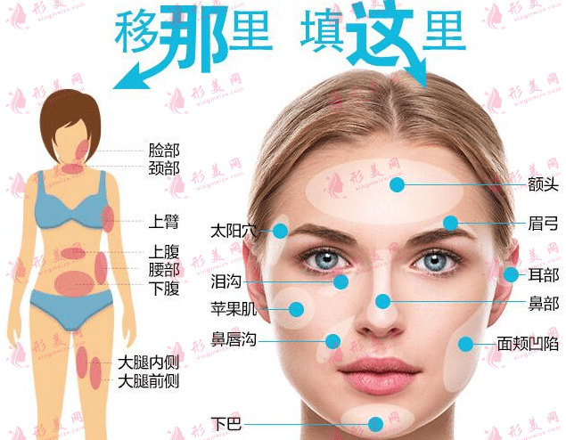 面部填充 面部填充