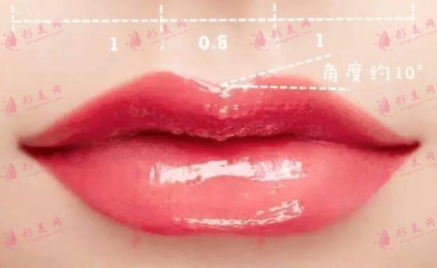 唇珠