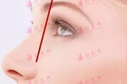 眼窩凹陷 眼窩凹陷