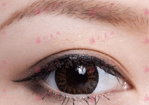 內(nèi)眼角
