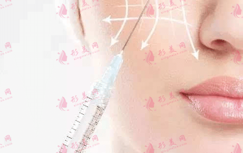 玻尿酸填充 玻尿酸填充