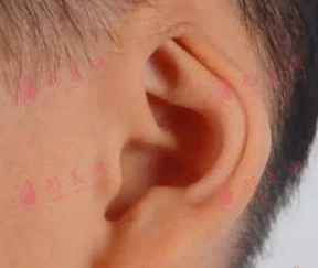 隱耳 隱耳