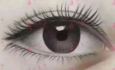 美瞳線