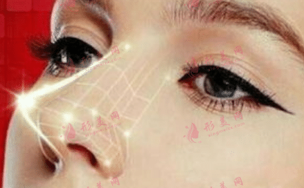 假體隆鼻