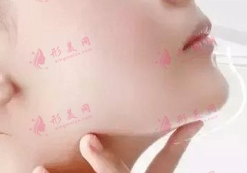 墊下巴 墊下巴