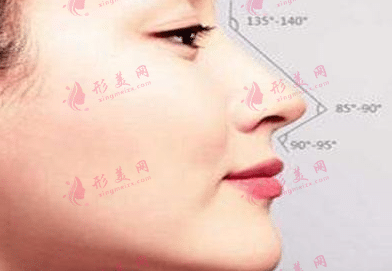 隆鼻 隆鼻