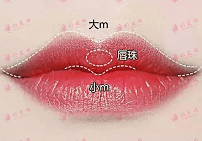 唇珠成形 唇珠成形