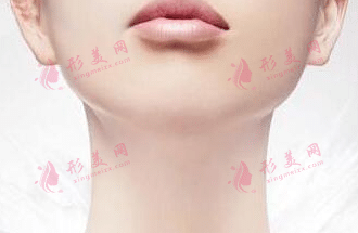 脖子除皺 脖子除皺