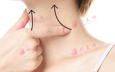 脖子除皺 脖子除皺