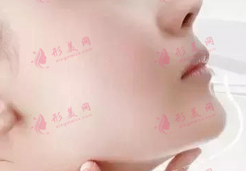 豐下巴 豐下巴
