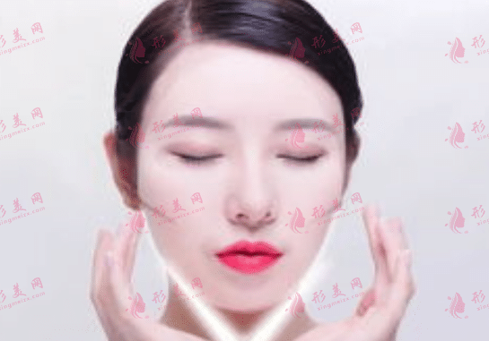 面部吸脂 面部吸脂