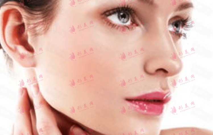 面部吸脂 面部吸脂