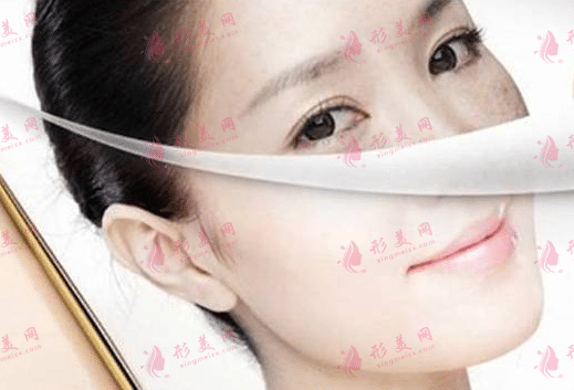 彩光嫩膚 彩光嫩膚