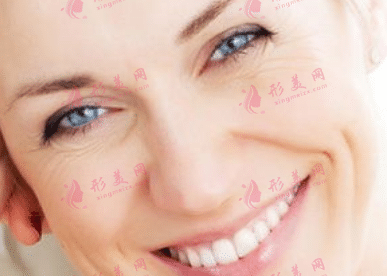 面部凹陷衰老 面部凹陷衰老