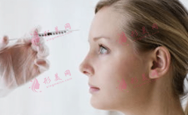 豐額頭 豐額頭