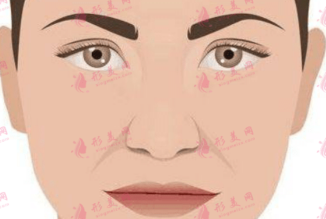 法令紋 法令紋
