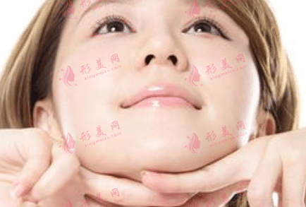 雙下巴 雙下巴