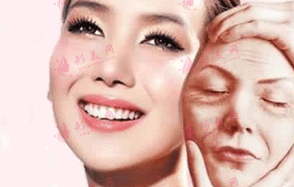 蘋(píng)果肌拉皮 蘋(píng)果肌拉皮