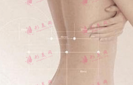 背部抽脂手術 背部抽脂手術