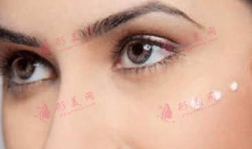 激光去脂肪粒 激光去脂肪粒