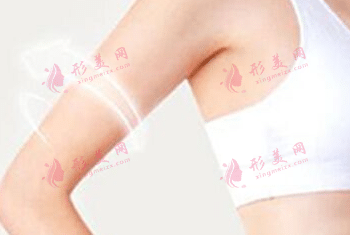 手臂吸脂 手臂吸脂