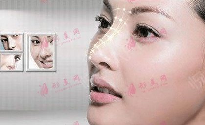 歪鼻矯正 歪鼻矯正