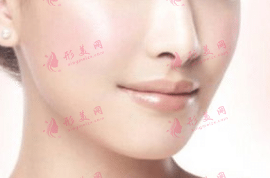 面頸部吸脂 面頸部吸脂