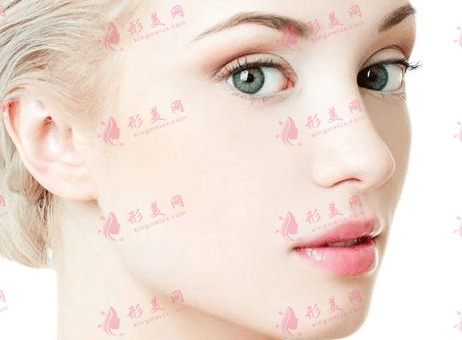 鼻翼縮小 鼻翼縮小