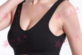 豐胸 豐胸