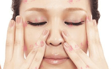 鼻翼縮小 鼻翼縮小